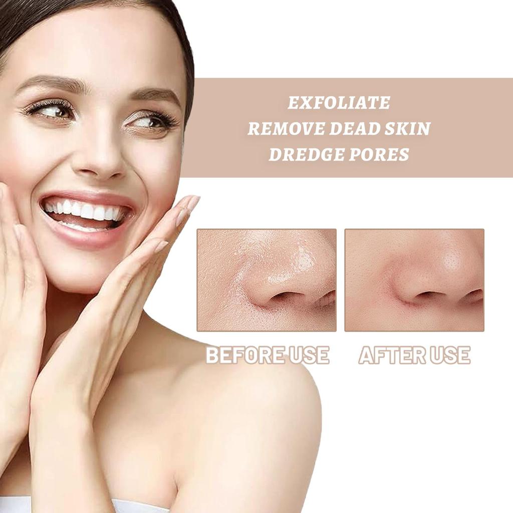 Exfoliating Gel Skin Gentle Cleansing Pore Shrinking Rejuvenating Exfoliating Blackhead & Acne Gel