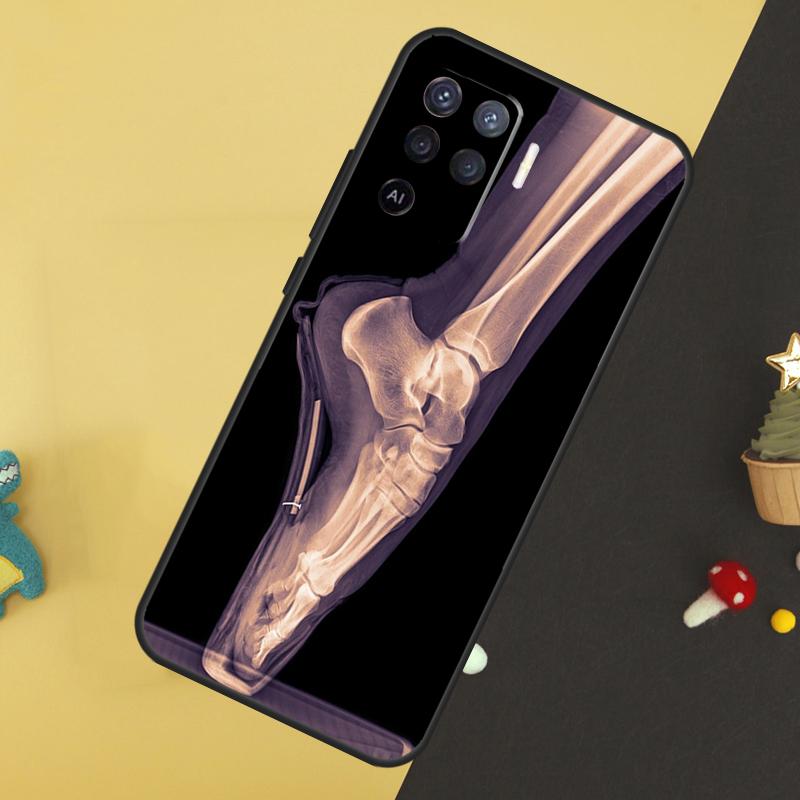 X-Ray Human Anatomy Case For Oppo A80 A60 A40 A54 A74 A94 A18 A38 A58 A78 A98 A96 A76 A16 A15 A17 A57 A5 A6 Pro