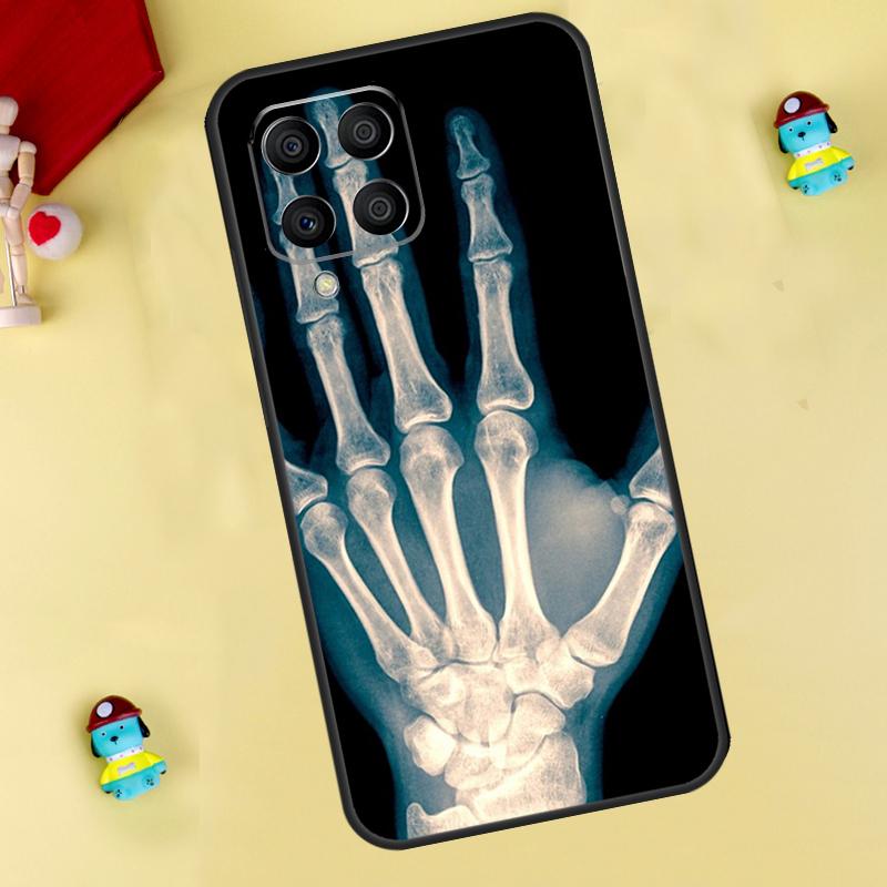 Skeleton Art Case For Samsung Galaxy M35 M55 M15 M11 M12 M13 M14 M06 M16 M36 M56 M31 M53 M32 M52 M34 M54