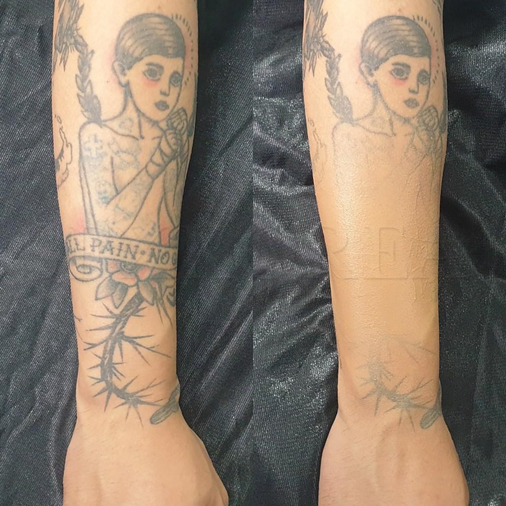 Tattoo cover, tattoo, vitiligo, scars, freckles, coffee spots, thin veins, blemishes concealer, SFX tattoo cover 1 set