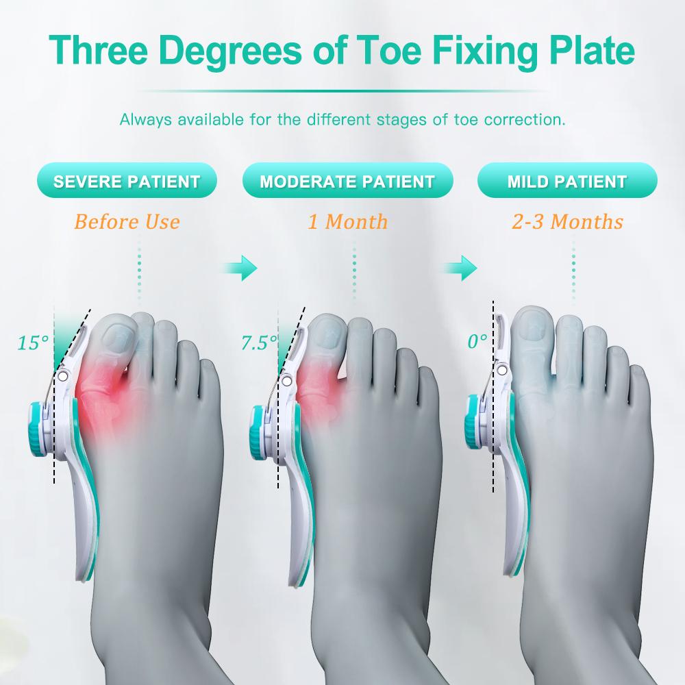 Merall Adjustable Hallux Valgus Toe Correction Foot Care Tool Toe Seperator Bunion Corrector For Women Orthopedic Foot Massager