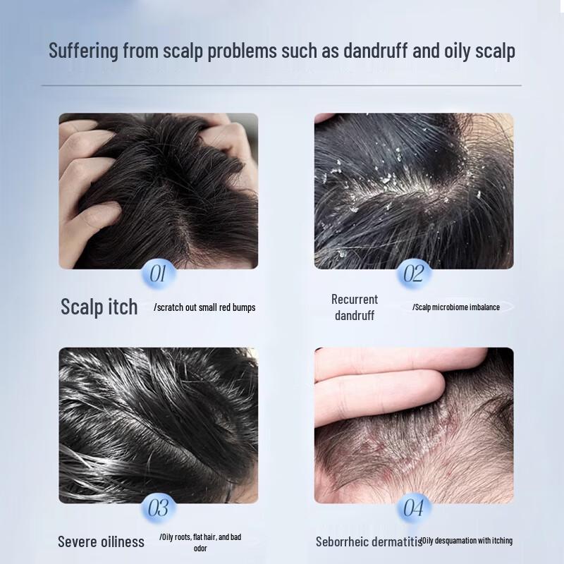 Nanjing Tong Ren Tang Selenium Disulfide Anti-Dandruff Itch Relief Shampoo