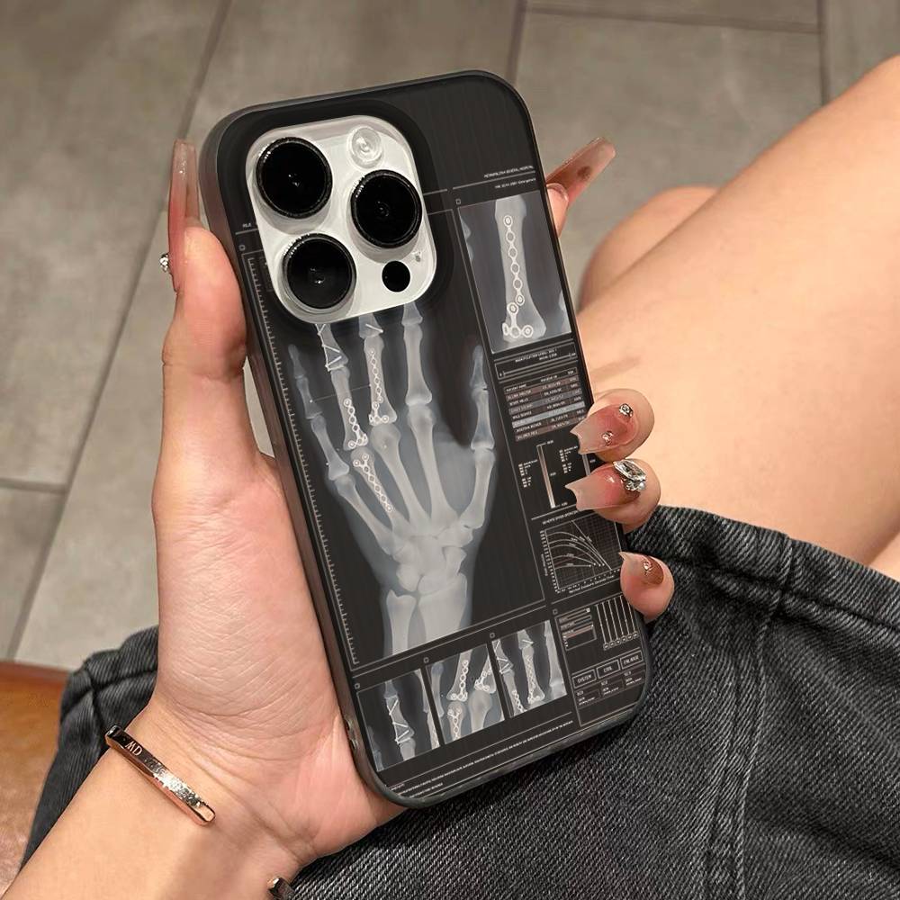 

Радиологический Человеческий Органы Скелет Чехла для Телефона Для IPhone 17 16 15 11 12 13 14 Pro Max Мягкий Гофрированный Силиконовый Чехол-Крышка iPhone 14pro max