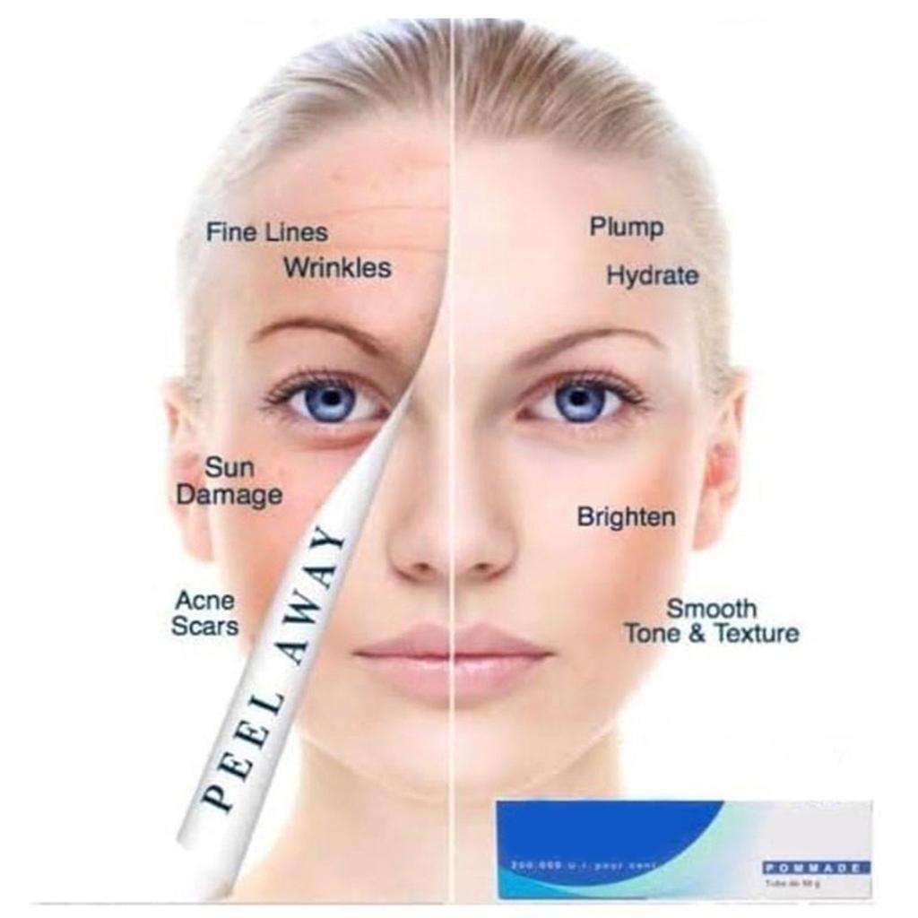 Retinol Pommade V A Night Mousturizer