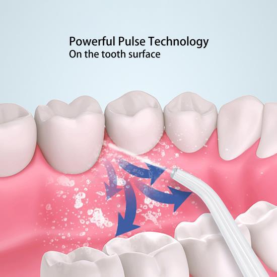 Portable Electric Dental Oral Irrigator Food Residues Removal White Teeth Cleaning Device