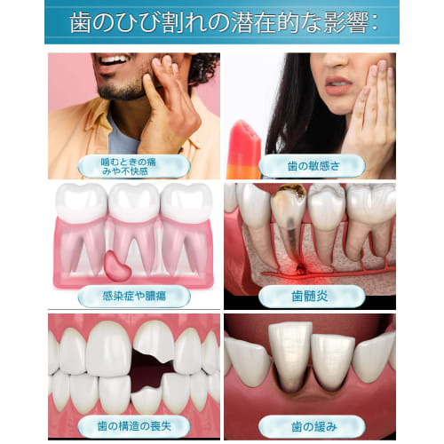 CAREDO Crack Repair Toothpaste, Enamel Repair, Fluoride-Free, Sensitive Teeth Care, Repairs Fine Cracks, Remineralizes Teeth, 100g