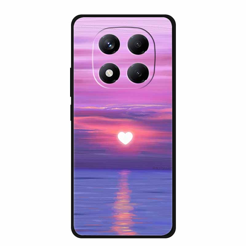For Redmi Note 15 Case China Version 6.77" Camera Lens Protector Silicone Soft Cover Funda for Redmi Note 15 5G Coque New Note15