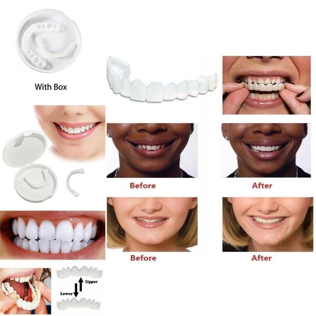 On Snap Fake Teeth Upper Lower Dental Veneers Denture Tooth Cover Set Simulation