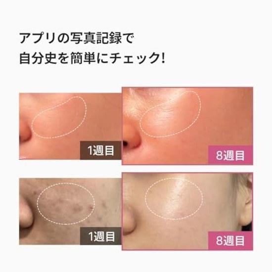 Medikube AGE-R Booster Pro Pink 1 Day 5 Minutes Korean Skin Experience Japanese Instruction Manual All-in-One Facial Device Portable 155g Gift