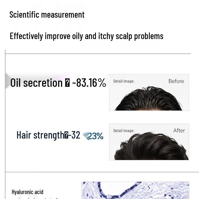 Long Hair Zhai Men's Scalp Care Shampoo