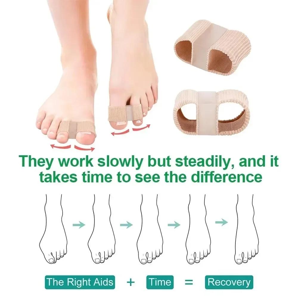 Silicone Two Toe Separator Straightener Effective Thumb Finger Correction Adjuster Bunion Hallux Valgus Corrector Foot Care Tool