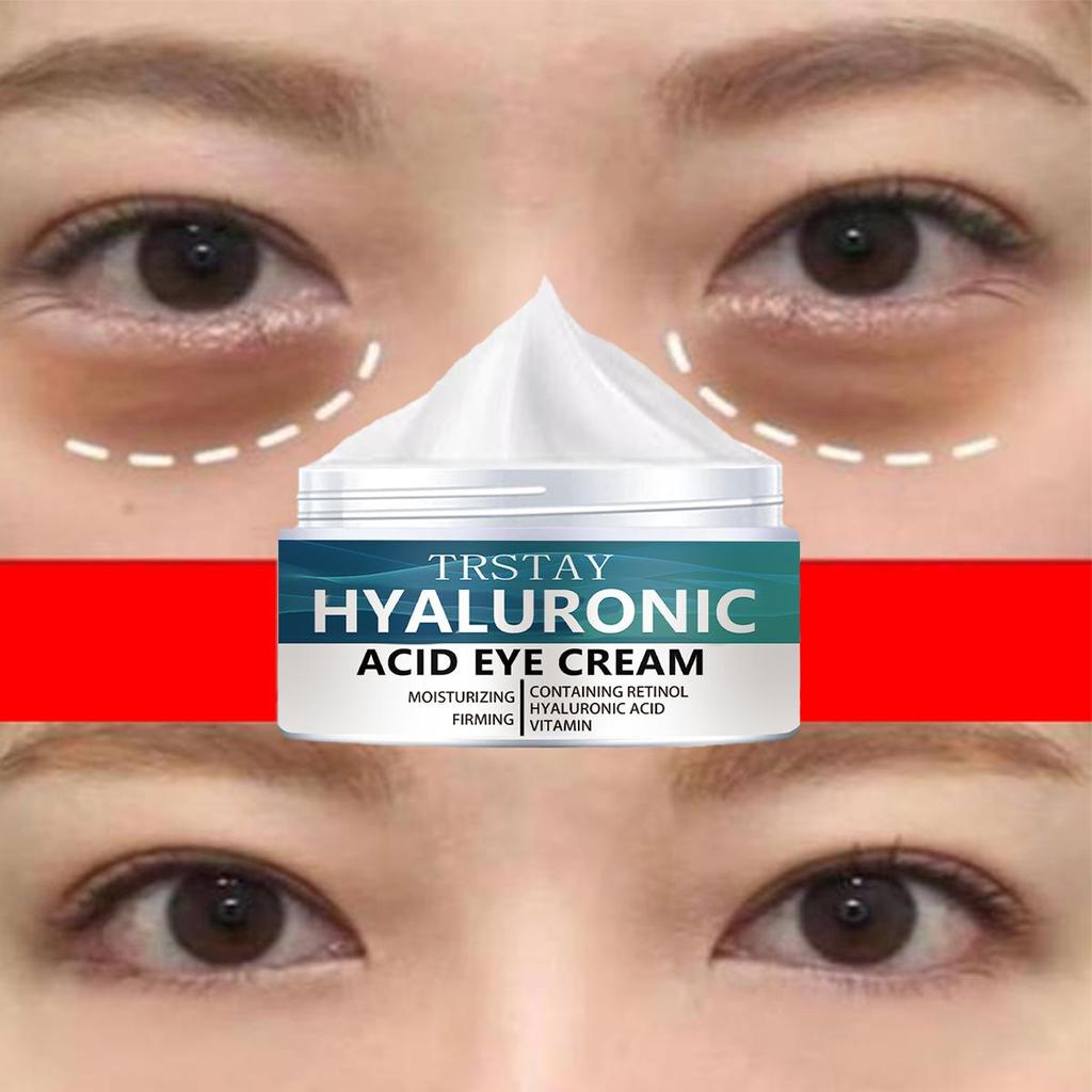The eye cream brightens and fades dark circles, pimples and eye bags, providing me with a firm and delicate eye treatment