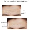 Curcumin VC Eye Cream VC Brightening Eye Cream Moisturizes Fades Fine Lines And Lightens Black Circles Under The Eyes