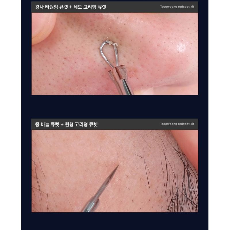 TOSOWOONG - Redspot Kit