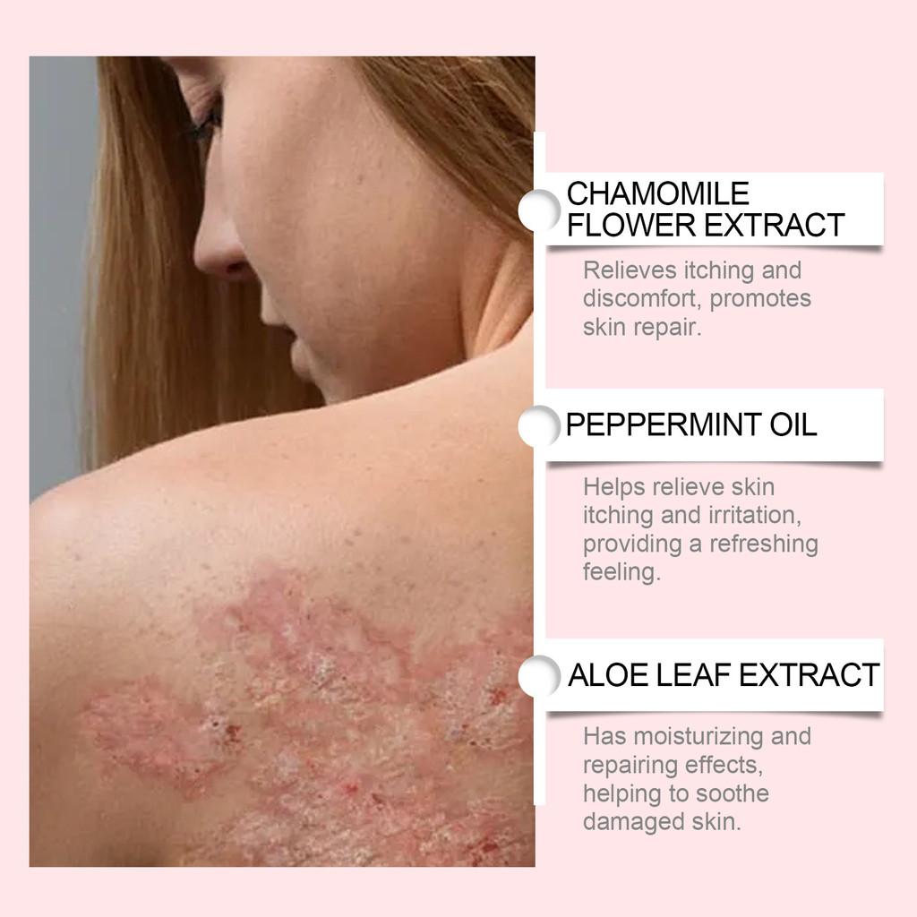 Ximonth Skin Repair Cream Nourishing Daily Care For Enhanced Skin Comfort 30g