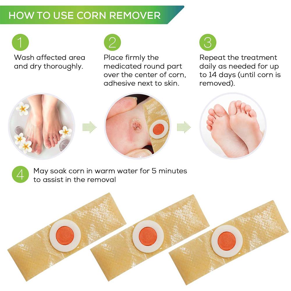 Foot Corn Removal Killer Calluses Plantar