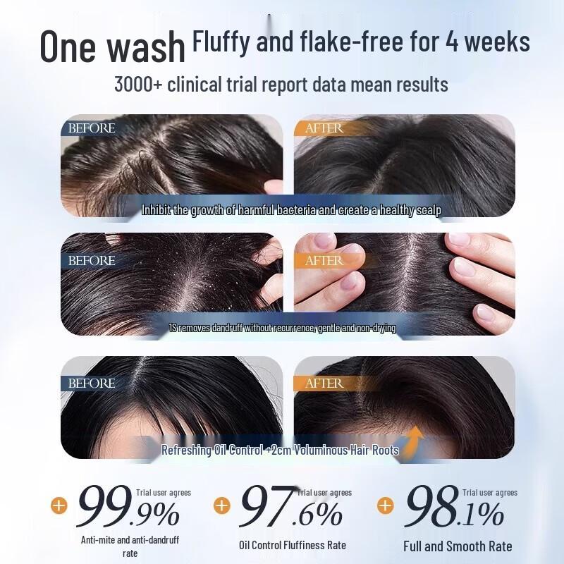 Hanbang Wugu Selenium Disulfide Refreshing Anti-Dandruff Shampoo