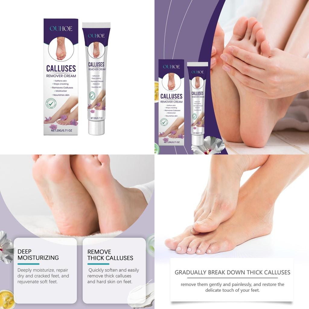 Ouhoe Foot Peel Repair Cream Gentle Moisturizing Softening For Dry And Cracked Skin