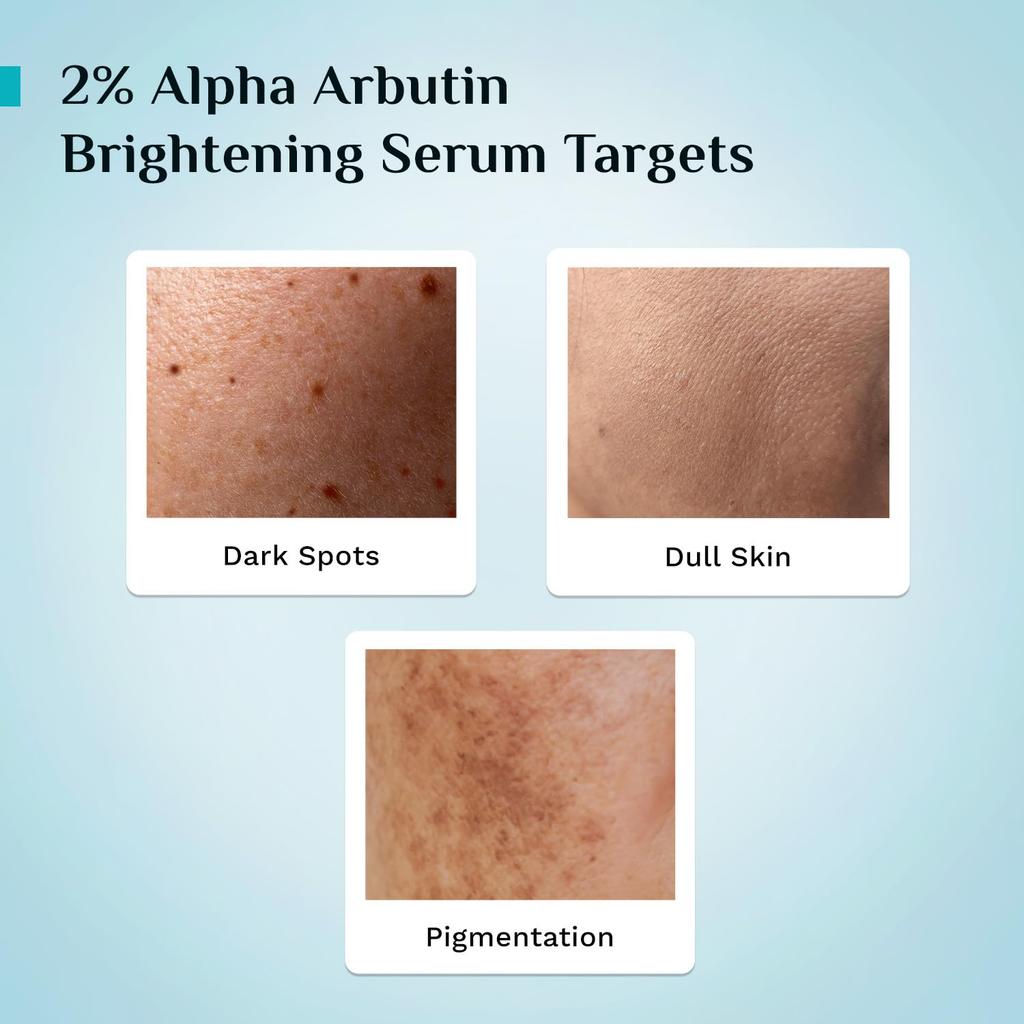 Pilgrim 2% Alpha Arbutin Brightening Serum, 30ml Each (Pack of 2)