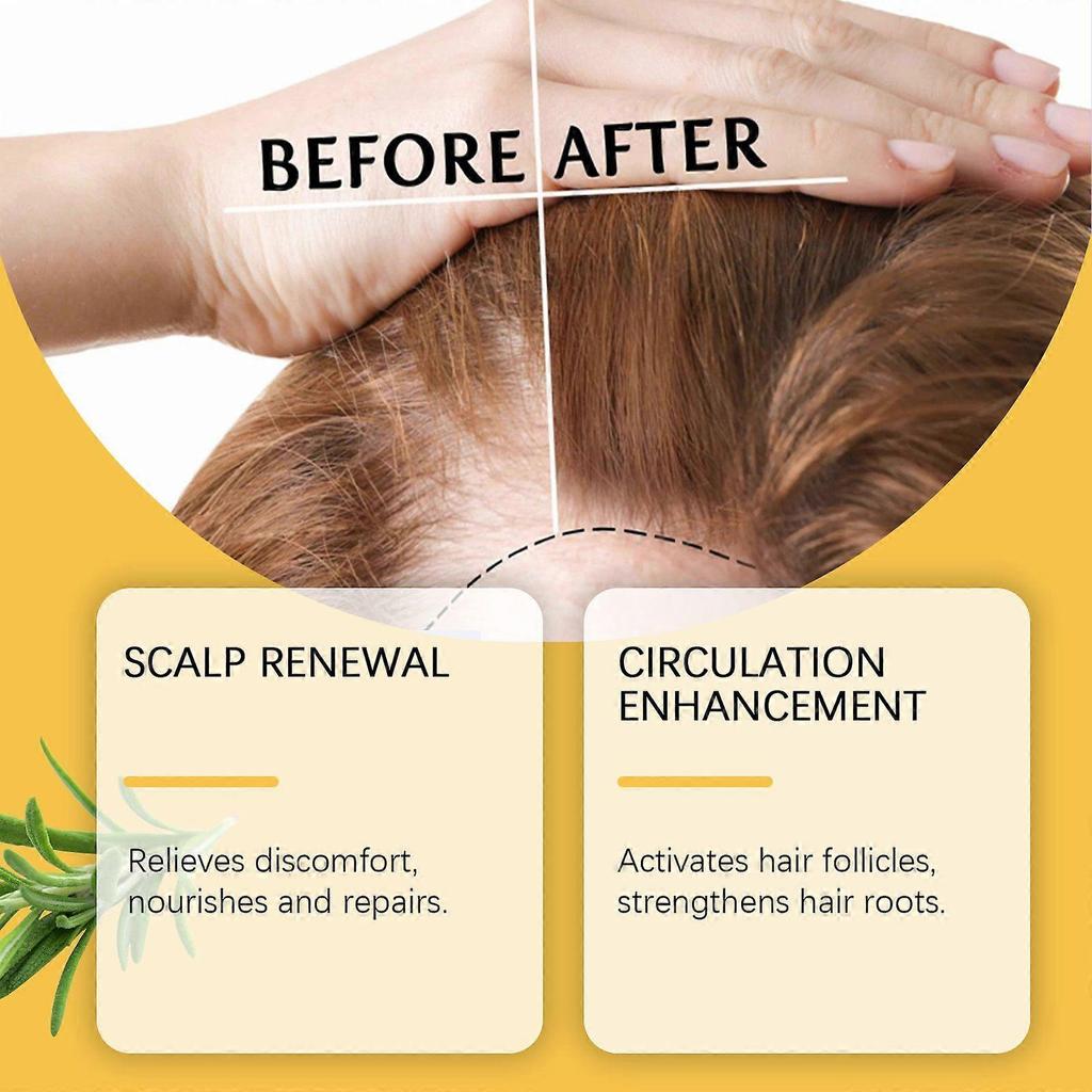 Hoegoa Nourishing Hair Care Essential Oil Nourishes And Strengthens Hair Strands, Moisturizes And Comforts The Scalp, And Protects Hair