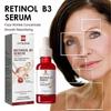 Retinol B3 Serum, Retinol Face Serum with Vitamin B3, B3 Retinol Serum for Face Anti Aging, Retinol Anti-wrinkle Serum Repair Wrinkles
