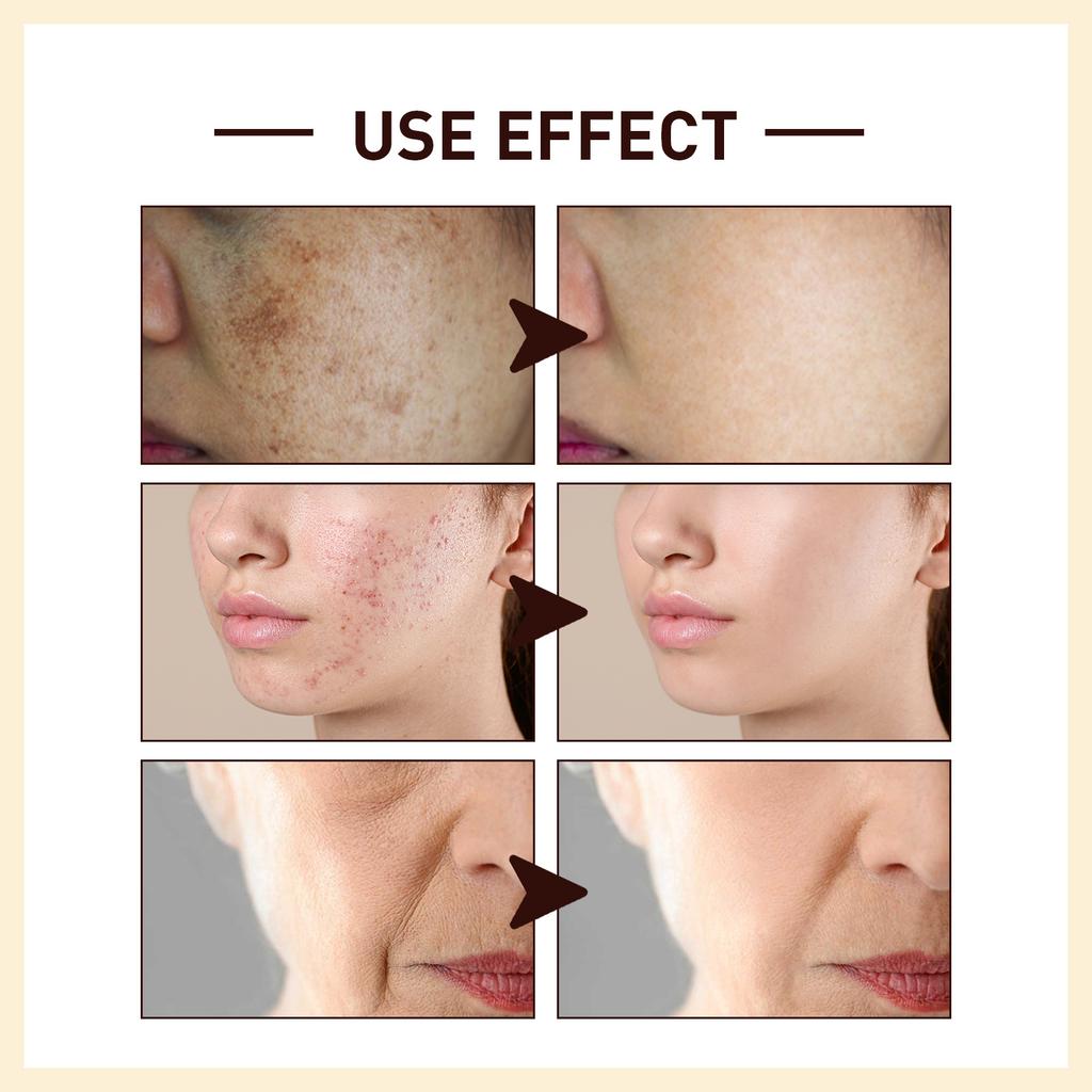 Moisturizing Essence Facial Tight Skin Hydrating Moisturizing Repair Moisturizing Refreshing Skin Care