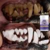 Clean Teeth, Antibacterial and Sterilization, Fresh Breath