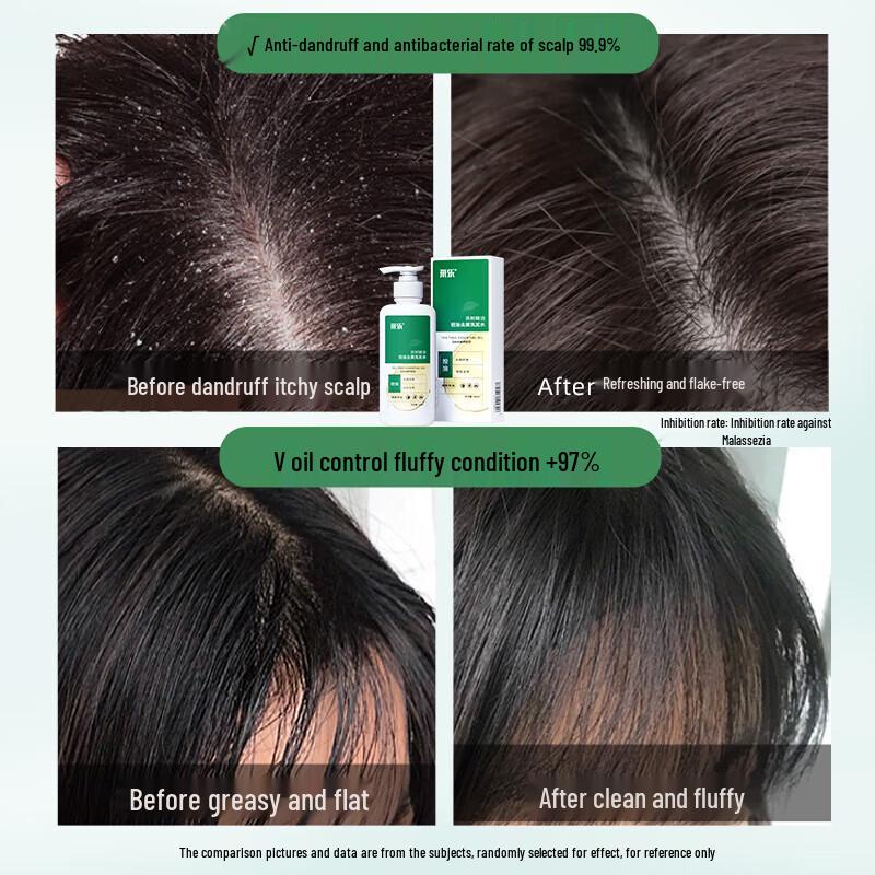 Cai Le Tea Tree Oil Anti-Dandruff Shampoo
