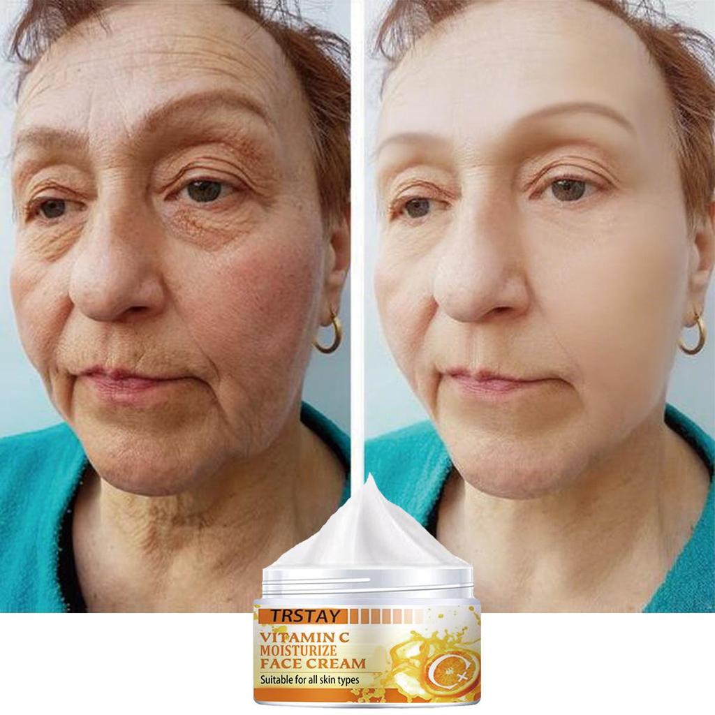 Moisturizing Cream Is Gentle and Non-irritating, Firms the Skin, Brightens the Complexion, Reduces Blemishes, Hydrates and Nourishes the Skin