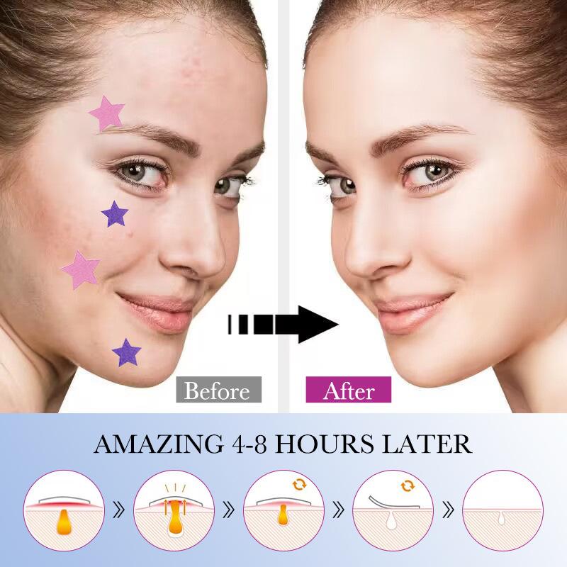 SADOER Colorful Star Acne Patch Student Acne Removal Acne Repair Patch