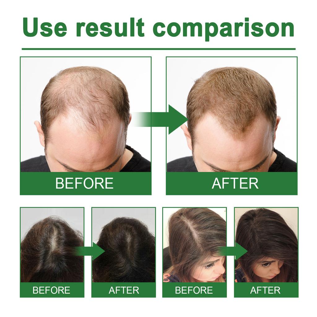 Rosemary Dense Hair Spray Moisturizes Hair Root Repair Damaged Hair Tough Hair Anti-Dense Hair Solution