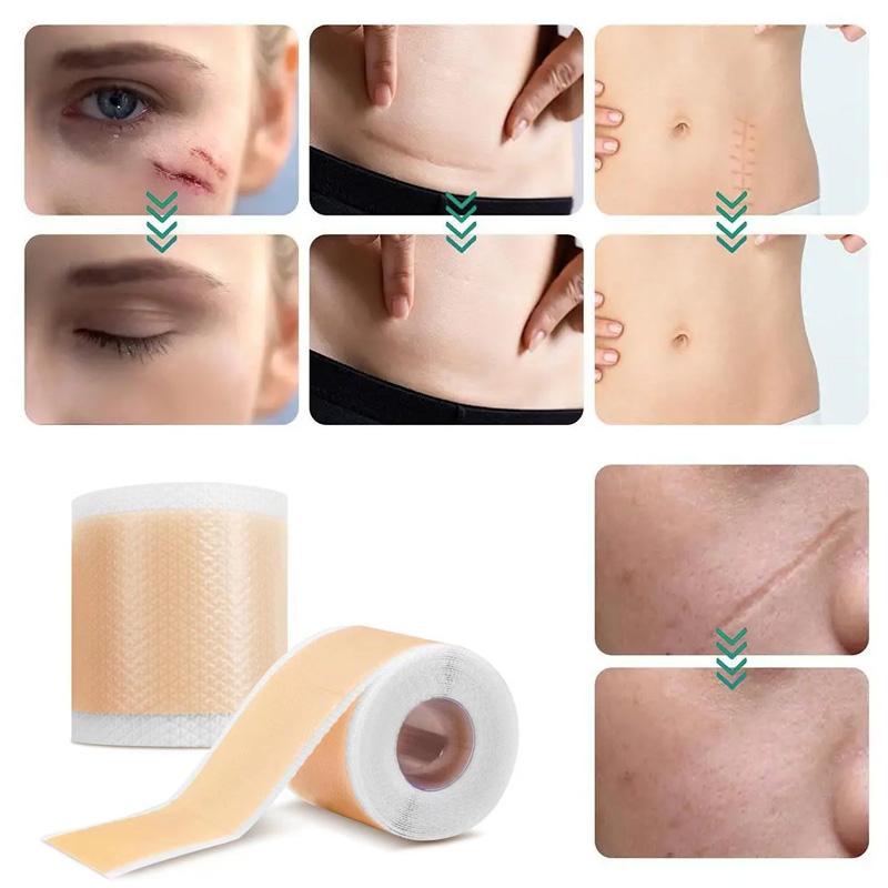 1 Roll Patch Skin Repair Self Adhesive 4X150CM Waterproof Scar Tape Non-slip Scar Sheets Skin Beauty Care Silicone Gel