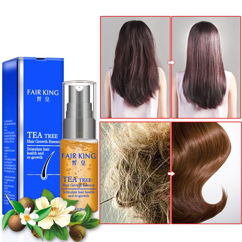 Buy Fair King Tea Tree Hair Growth Essence Hair Loss Products Essential