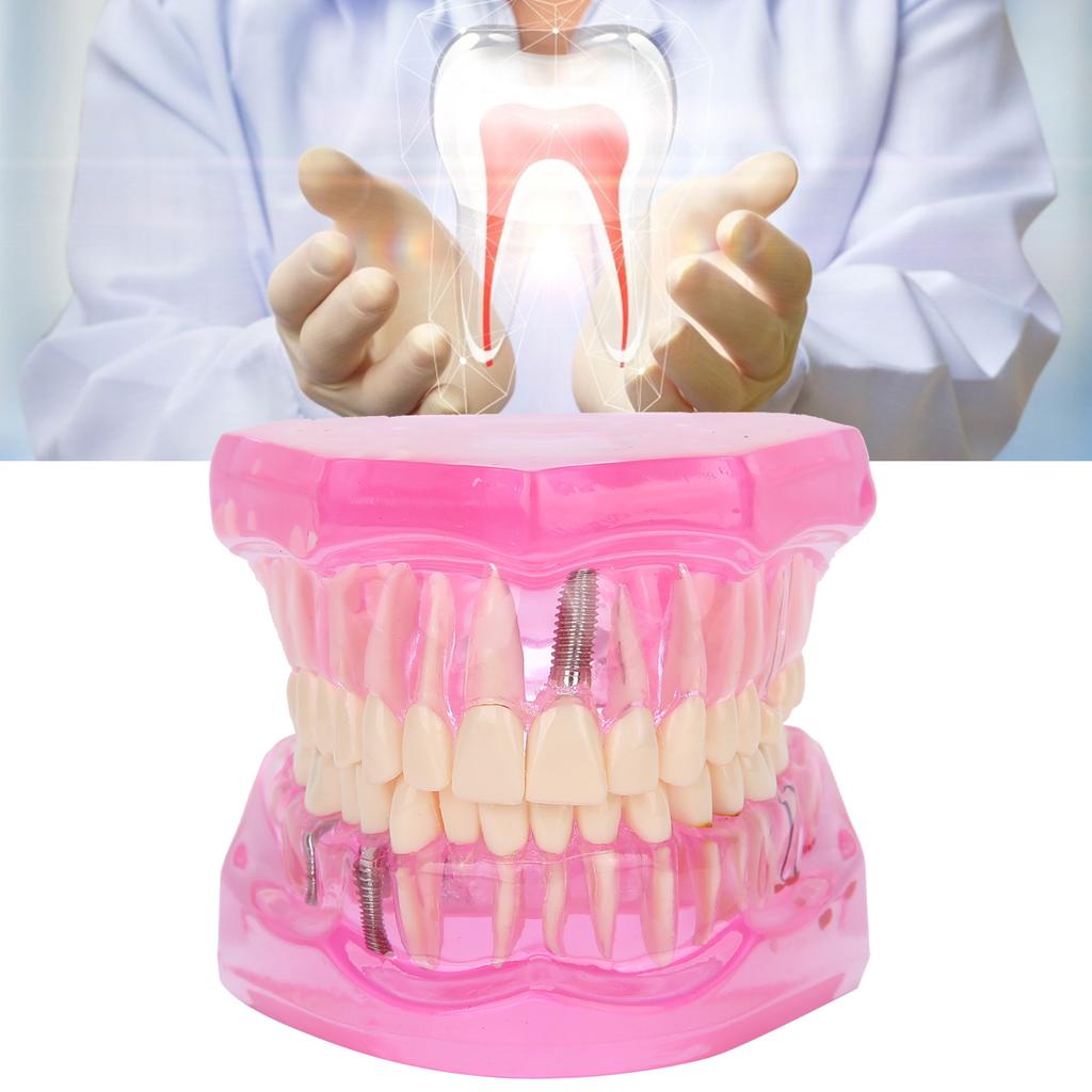 Transparent Adult Teeth Model Pathological Repair Studying Dental Teaching Tools