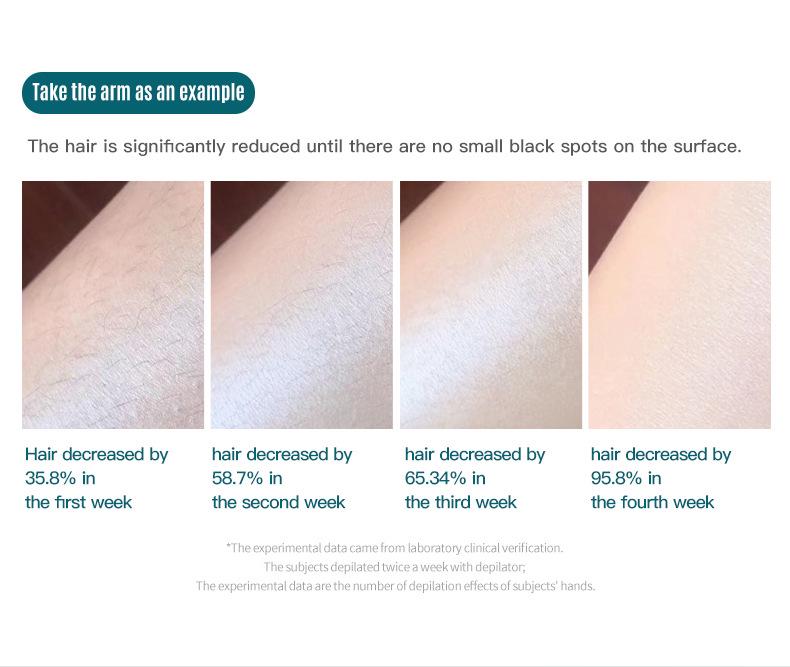 Full Body IPL Hair Removal Device with Painless Ice Sensation Therapy