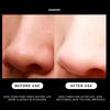 10/20pcs Cleansing Nose Pores And Blackheads - Nose Cleaning Patch, Cleansing Facial Care Tool