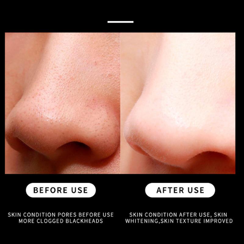 10/20pcs Cleansing Nose Pores And Blackheads - Nose Cleaning Patch, Cleansing Facial Care Tool