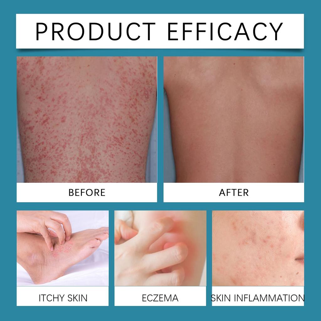 Skin Soothing Cream Mint Artemisia Sophora Flavescent Moisturizing Scalp Facial Care Cream