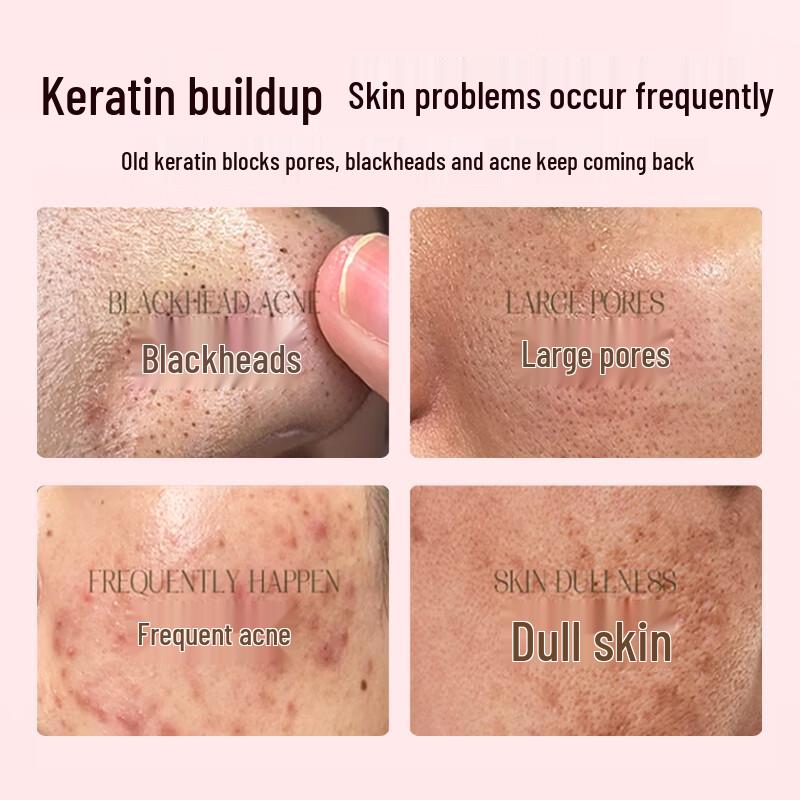 

Beauty Notes Fruit Acid Exfoliating Gel