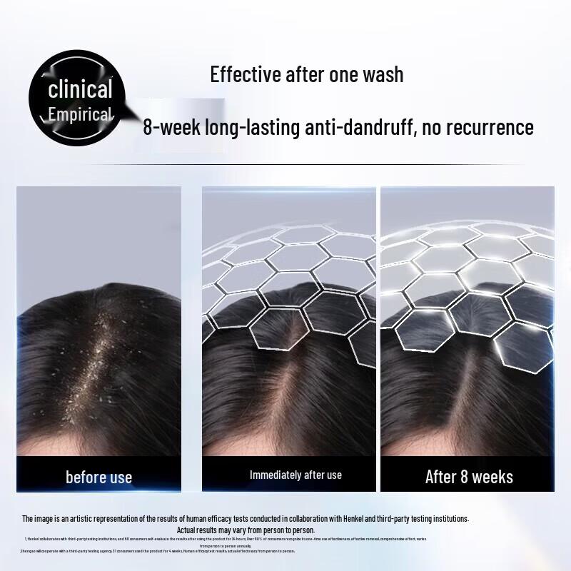 Schwarzkopf Green Scent Anti-Dandruff Shampoo (10x600ml Pack)