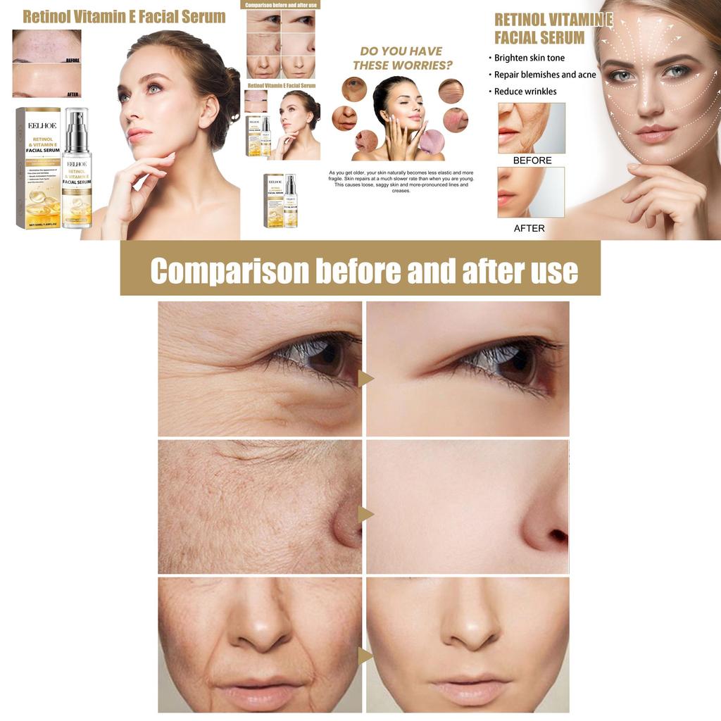 Eelhoe Retinol Vitamin E Night Facial Serum For Radiant Skin Hydrating Brightening Essence