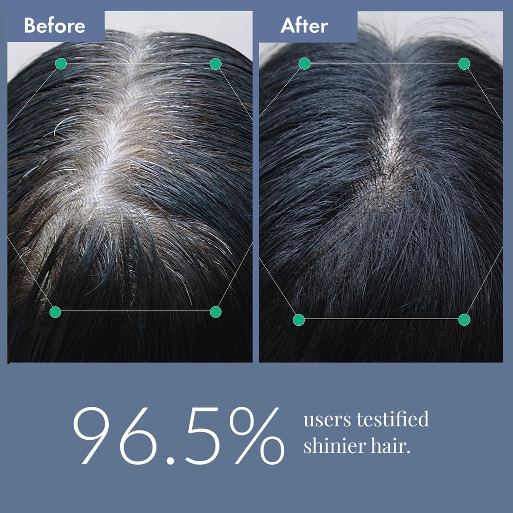 ThriveCo Anti Grey Hair Prime Serum | Naturally Reverse Greying Hair & Beard | With Arcedin® + Arcolys® + Biotin |Men & Women |30 ml