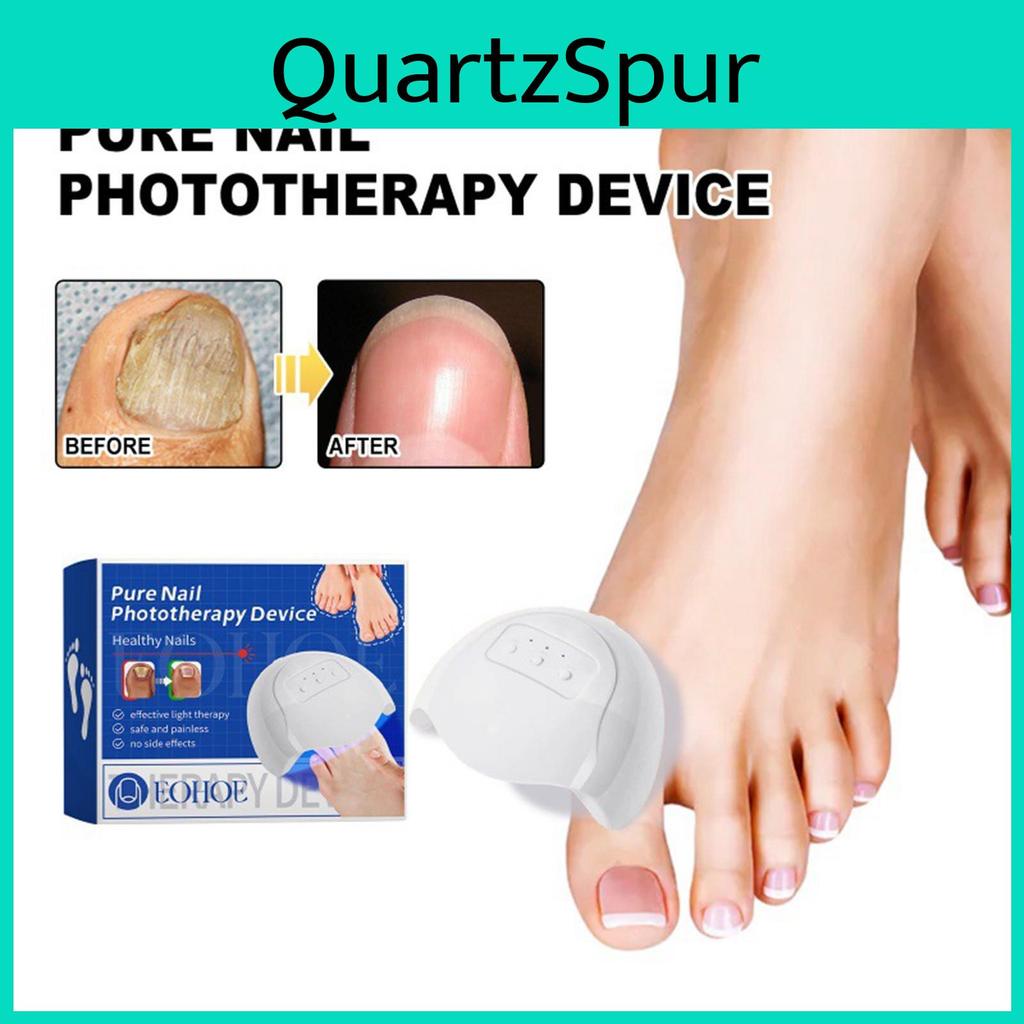Care Nail Repairs Device Rotten Nails Ingrown Toenails Thickens Nails Brightens Nails Gently Cleans Onychomycosis And Cares For Onychomycosis