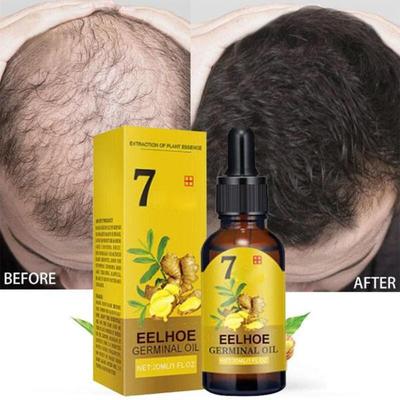 Ingwer-Haarwachstumsprodukte, schnell wachsendes Haar, ätherisches Öl, natürlich, gegen Haarausfall, verhindern trockenes, krauses, beschädigtes Haar, Reparaturpflege