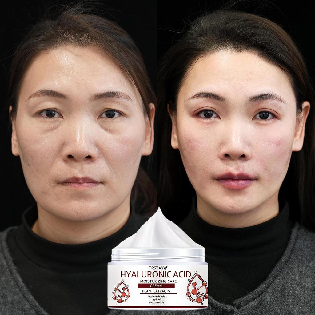 A moisturizing cream that improves skin elasticity, brightens skin tone, helps reduce wrinkles, and absorbs quickly