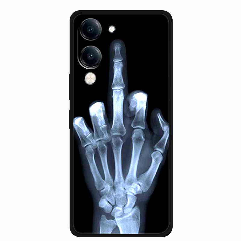 For Vivo iQOO Z10 Lite Case Silicone Black TPU Funda Back Cover for iQOO Z10 Lite 5G I2409 Soft Case Animal Coque IQOOZ10 Lite