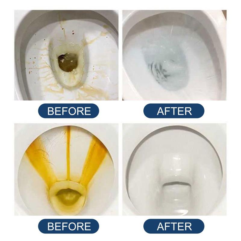 Toilet Bowl Effervescent Tablets Toilet Bowl Cleaning Yellow Stains Urine Stains Dirt Toilet Cleaning Toilet Deodorization Deodorization