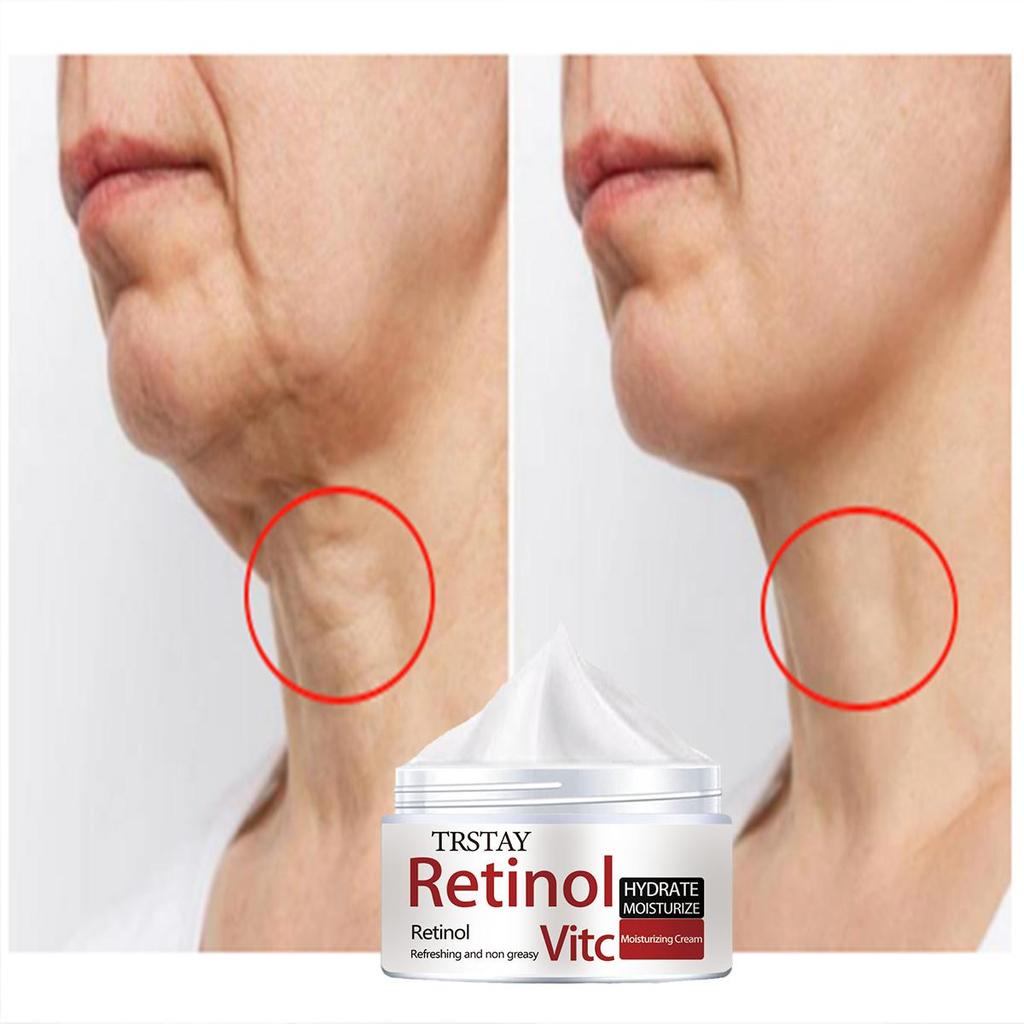 Straffende Creme für den Hals, Gesichtscreme, Retinol, reduziert das Erscheinungsbild der Hautalterung, glättet Falten und verbessert die Hautaktivität. Jugendliche Feuchtigkeitscreme