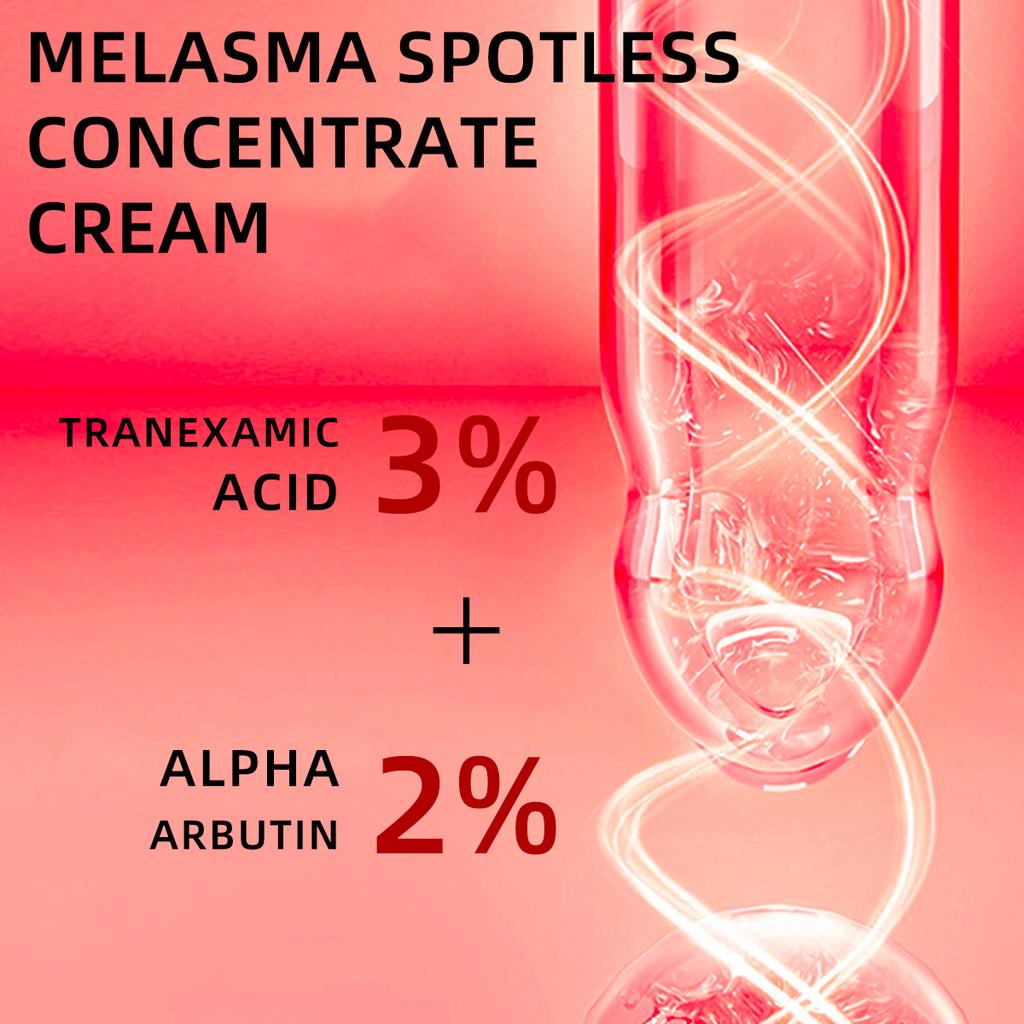 Bělící koncentrát na tmavé skvrny, hluboce rozpouštějící, přírodní extrakce, účinný krém na odstranění pigmentu, krása