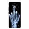Capa Para ZTE Blade A73 5G Animais Silicone Macio TPU Capa de Telefone Para ZTE Blade A73 5G 7160N Capas Lobo Fruta Estampada Fofa Coque